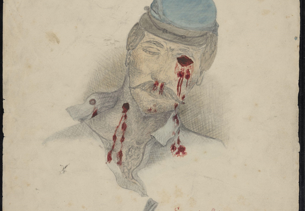 Bullet wounds in the right eye and neck. Stone's River, Tennessee.