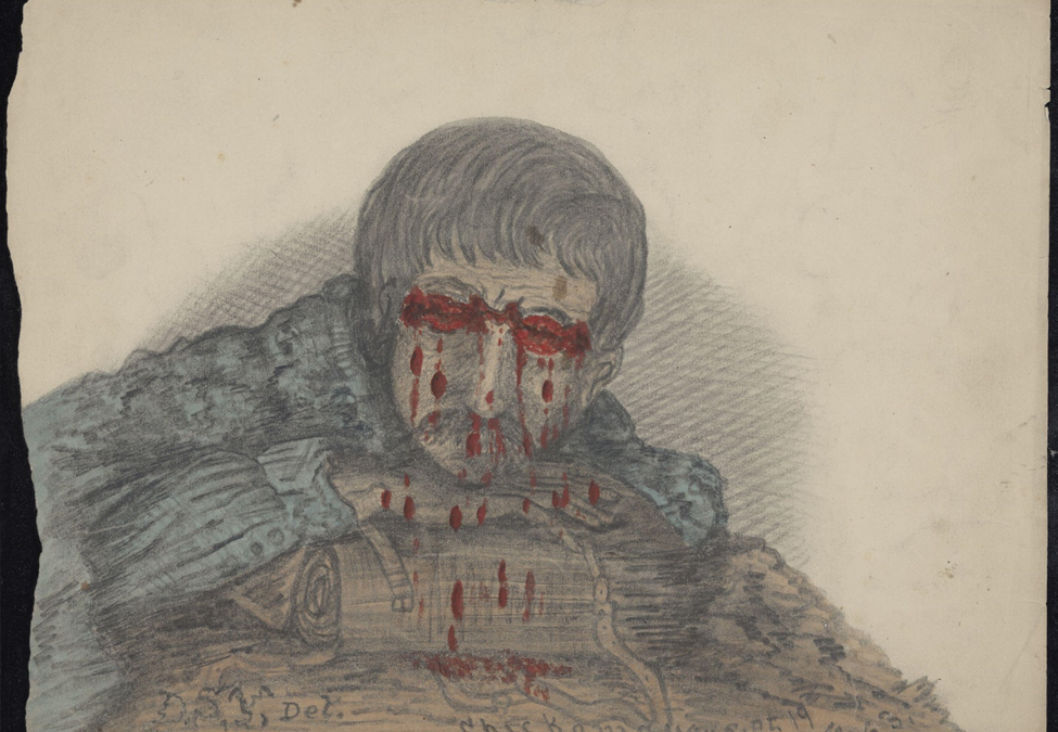 Soldier with eyelid and nose lacerations. Chickamauga, Georgia.