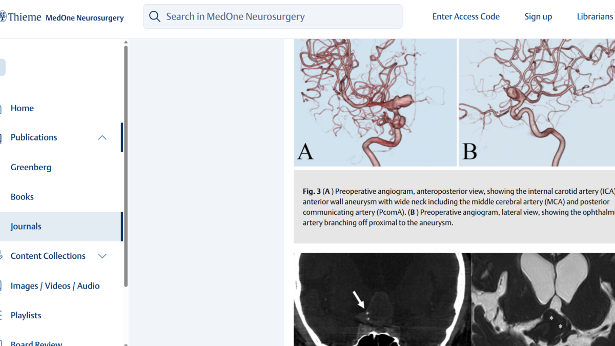 angiogram of an arterial aneurysm before and after surgery.