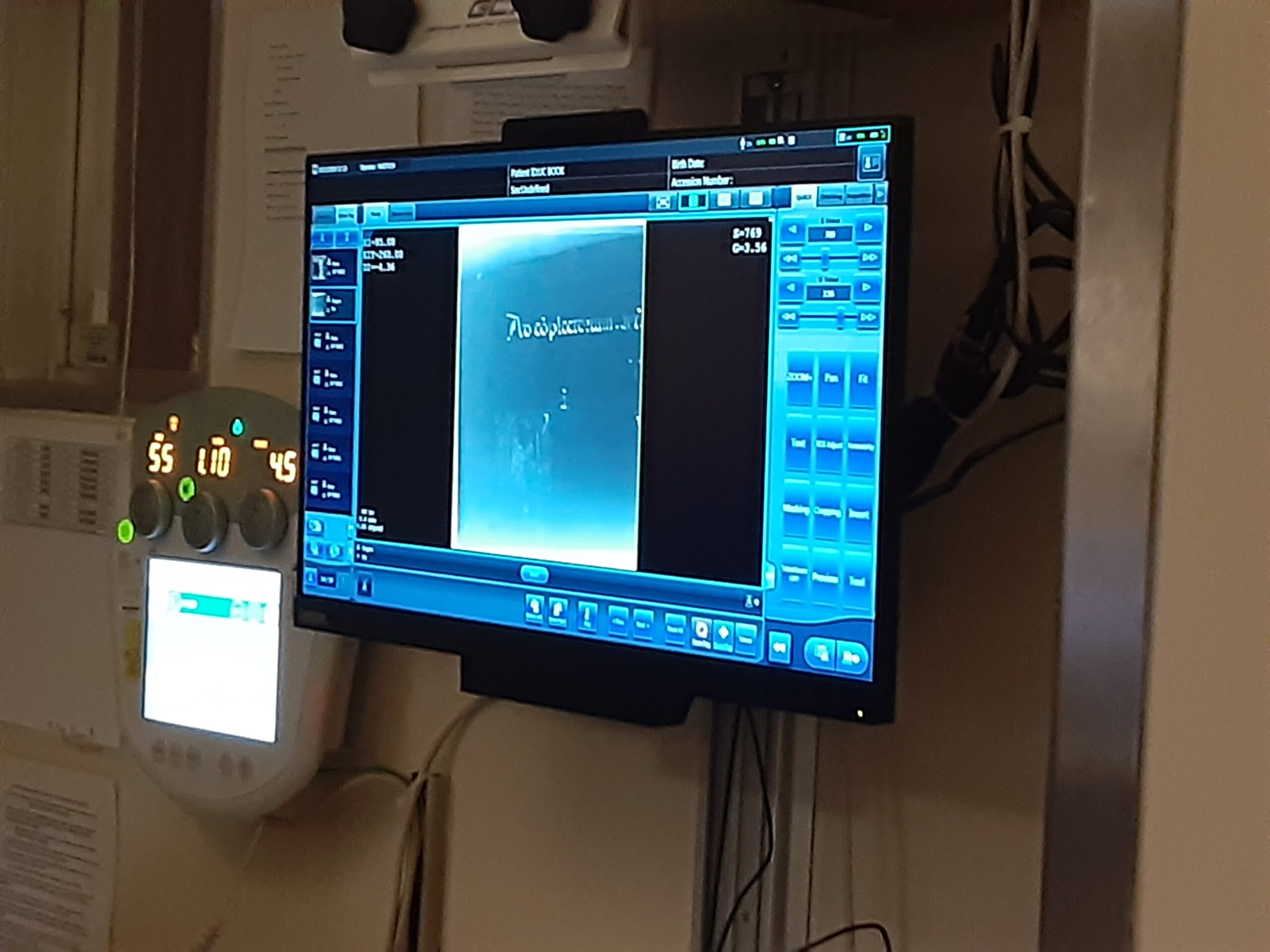 Viewing x-ray images on screen