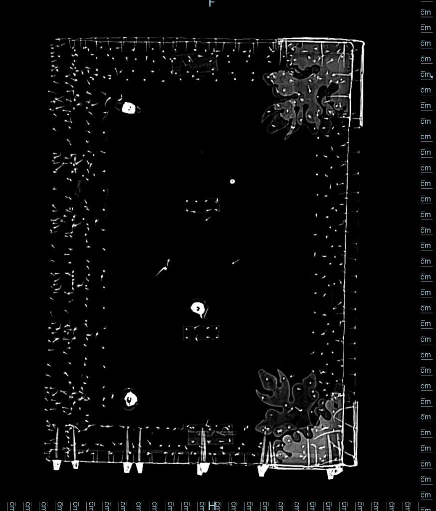 Still image from CT scan