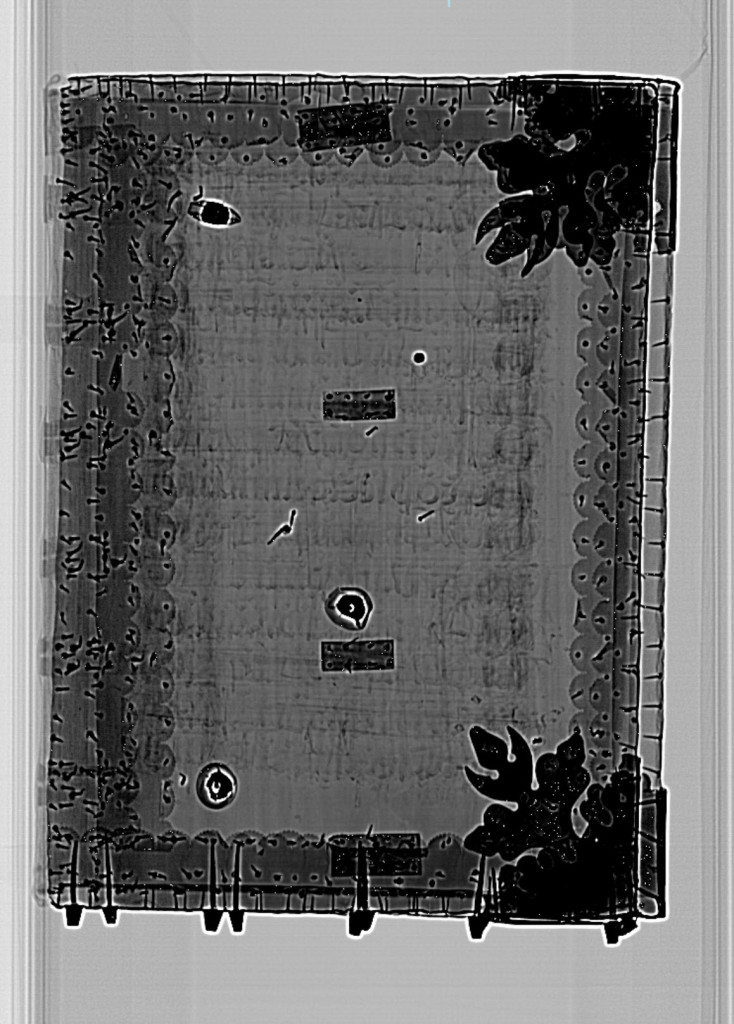 Still image from CT scan