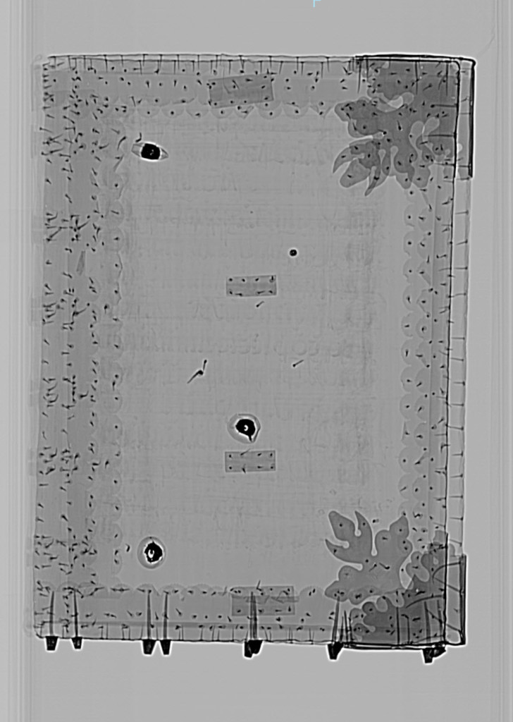 Still image from CT scan