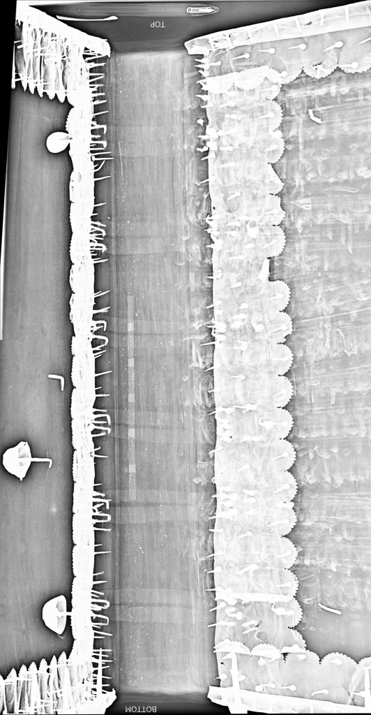 X-ray image of the spine