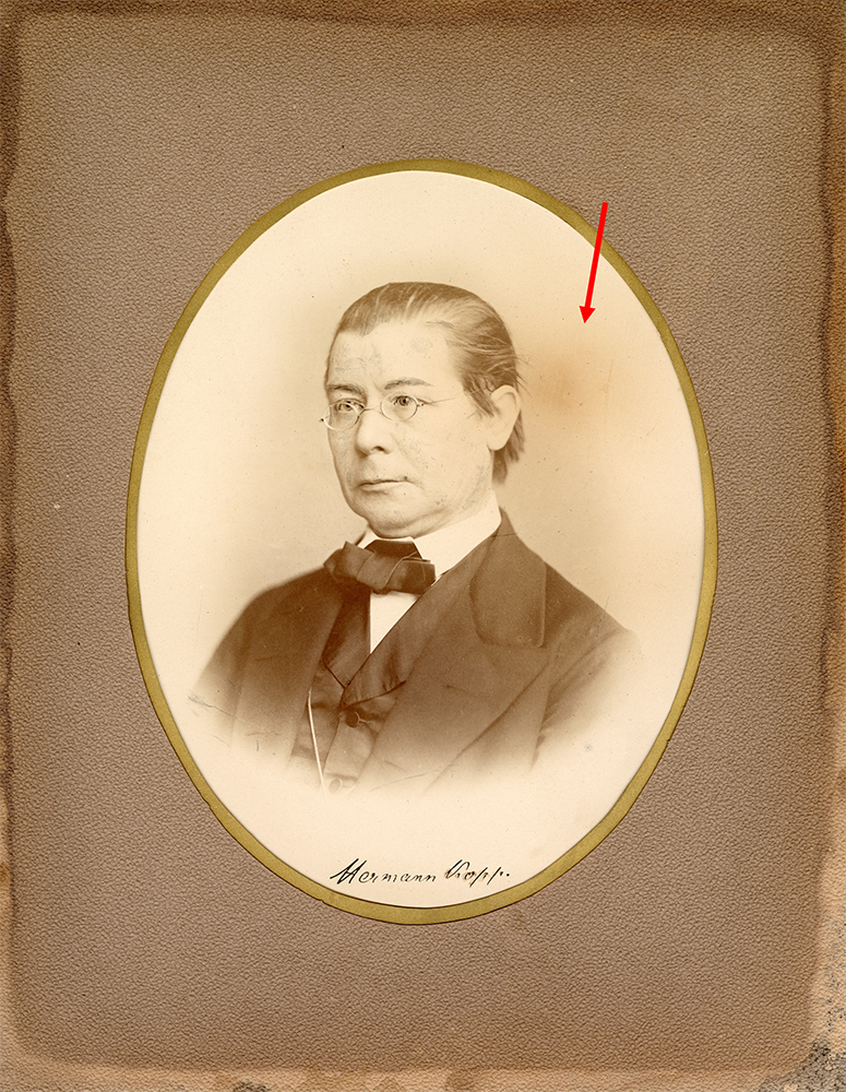 Photograph of a man in a suit with a red arrow pointing to spot where the large brown spot once was to the right of his head, but now has been digitally removed.