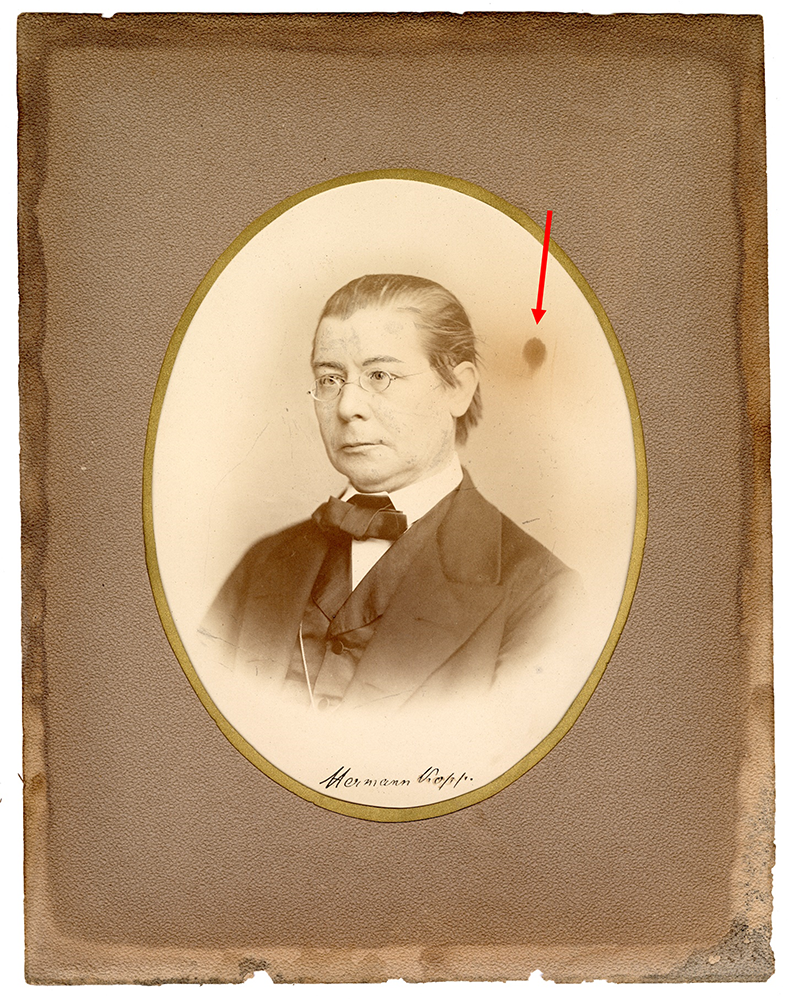 Photograph of a man in a suit with a red arrow pointing to a large brown spot to the right of his head.